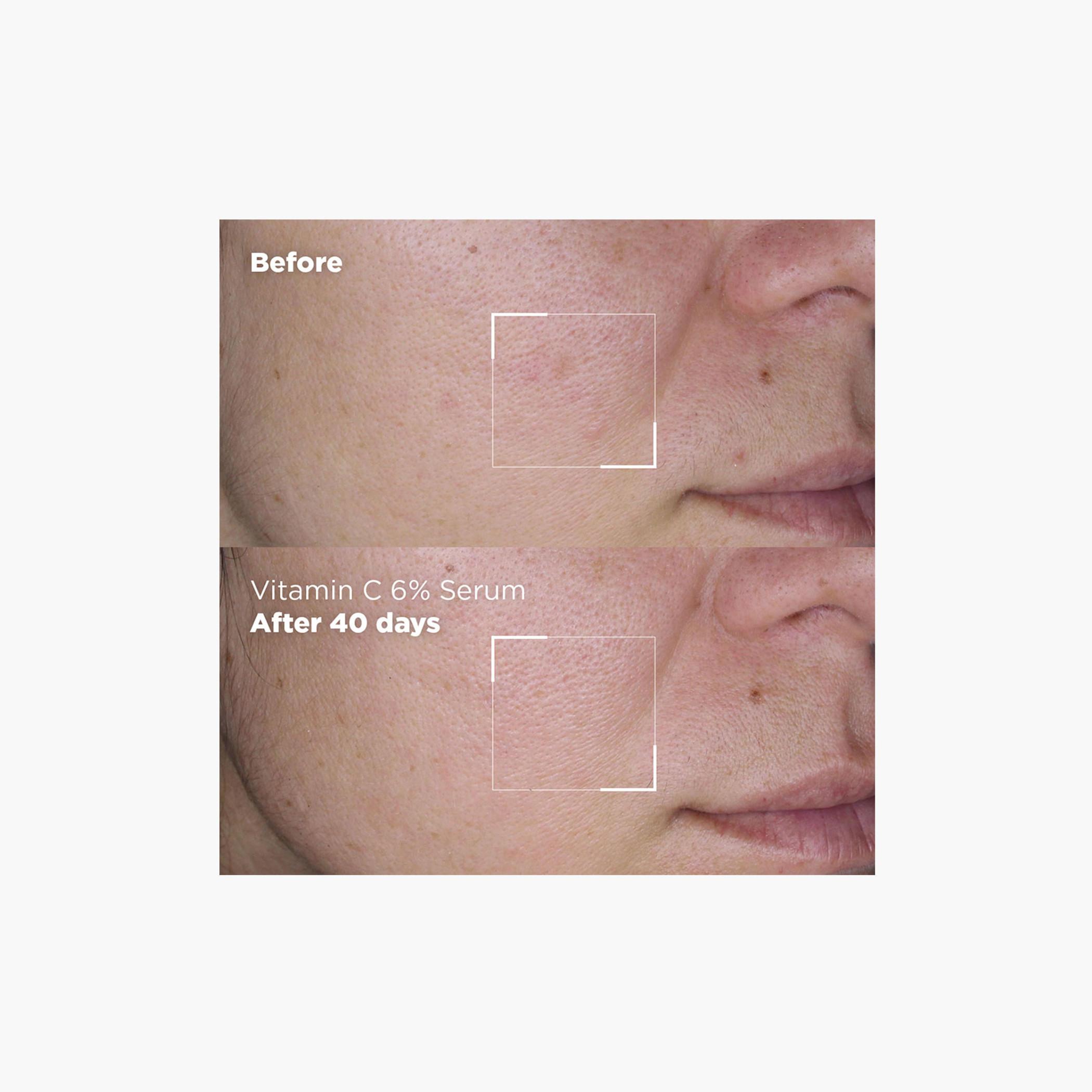 سكين ريبابلك سيروم الوجه فيتامين سي 6٪ لإشراقة البشرة وتفتيح لونها 30 مل-beautyandpersonalcare-skin-treatmentsandserums-image-7