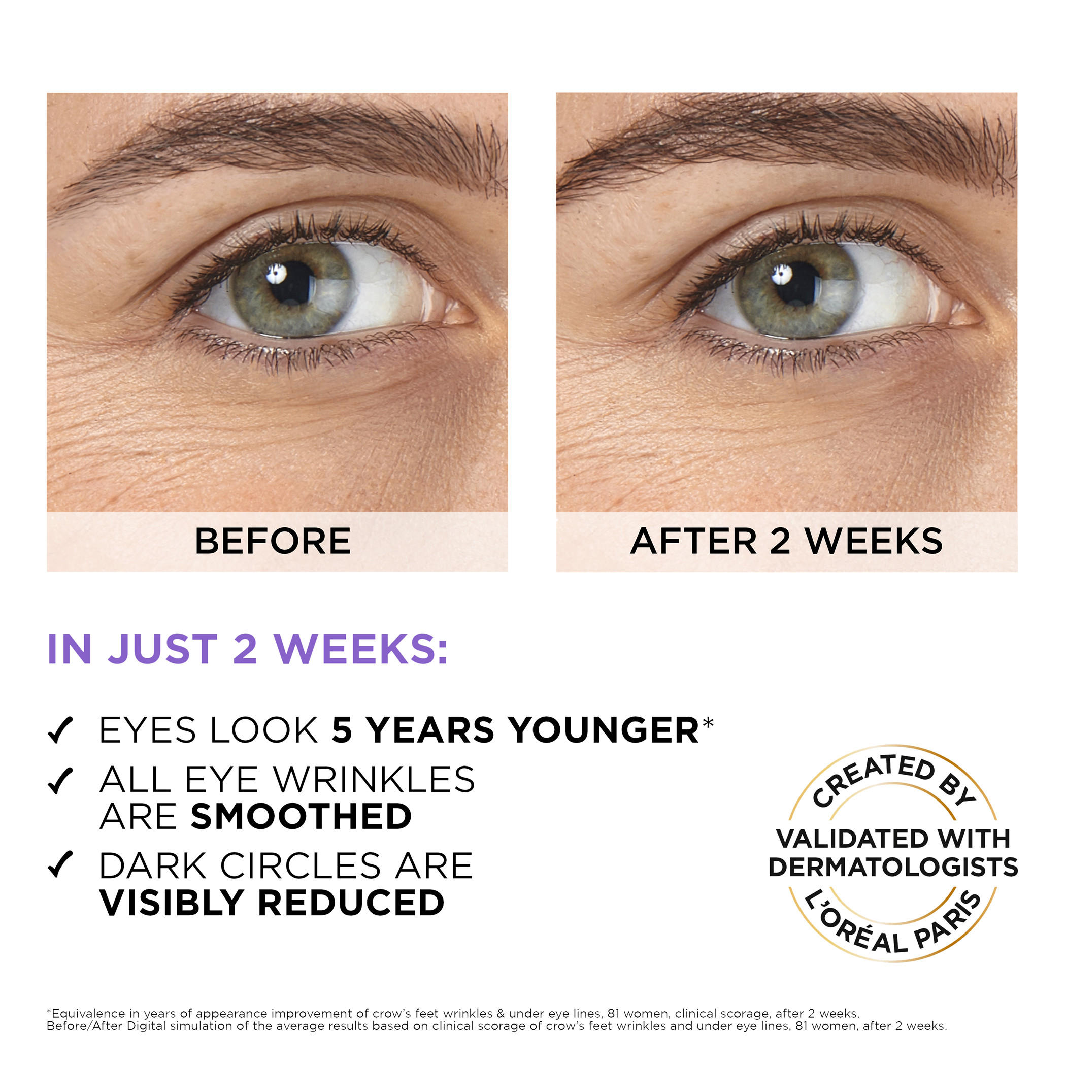 L'oreal Paris Hyaluron Expert Eye Serum - 20 ml-beautyandpersonalcare-skin-eyecare-image-6
