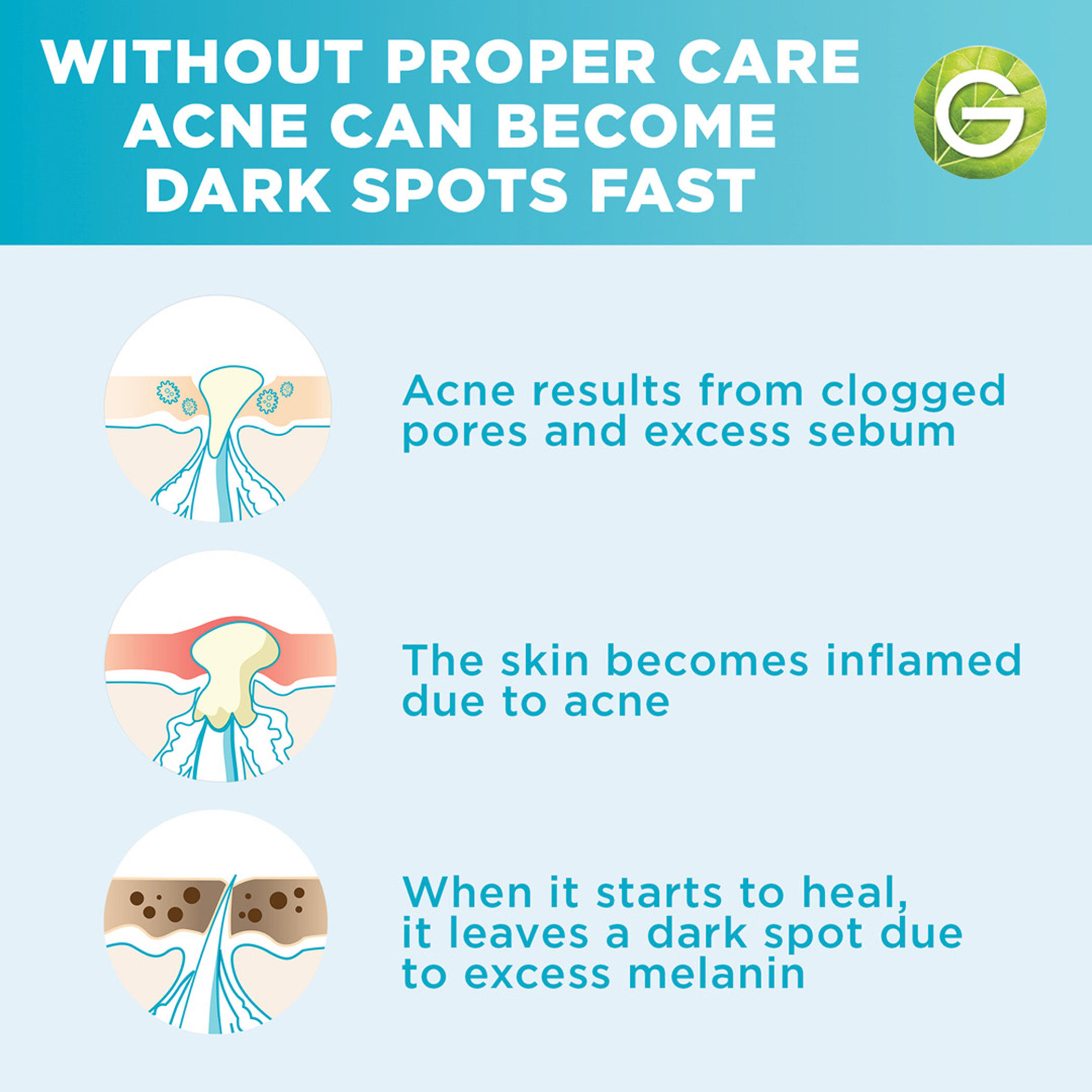 Garnier Skinactive Fast Clear Anti Acne Booster Serum - 15 ml-beautyandpersonalcare-skin-treatmentsandserums-image-11