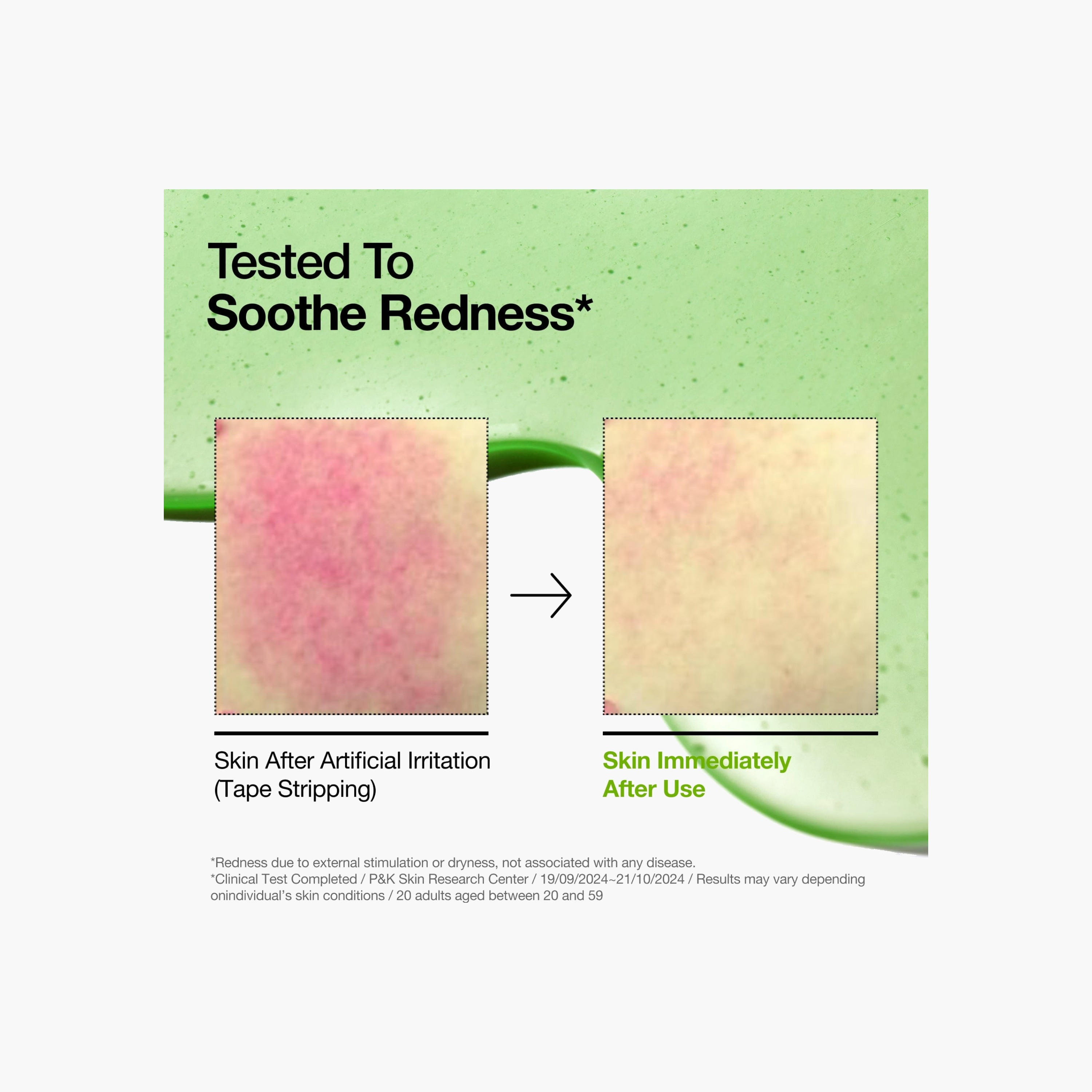 مصل مهدئ للاحمرار بحمض الأزيليك من أنوا-beautyandpersonalcare-kbeauty-skin-treatmentsandserums-image-2