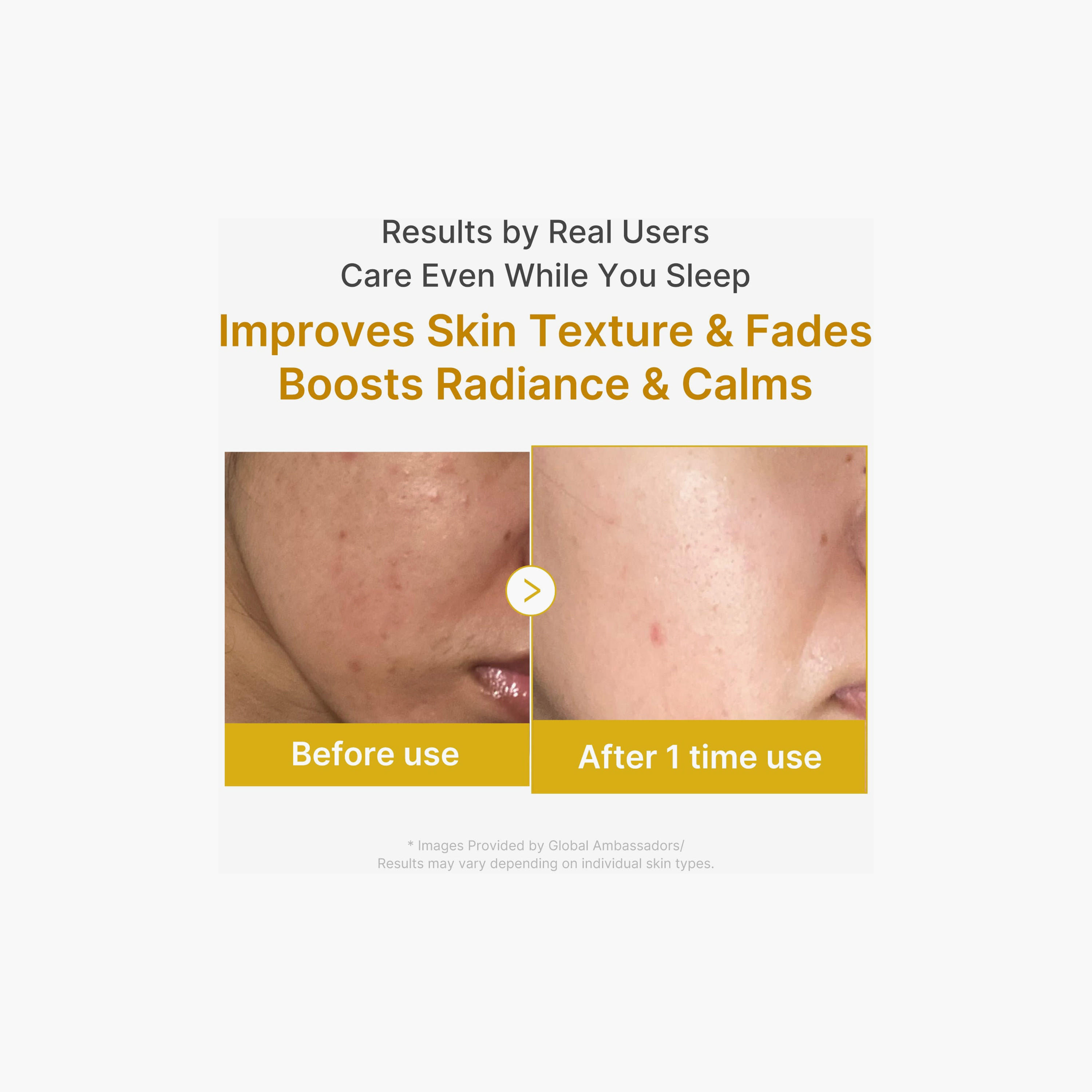 قناع ميديكوب الليلي بالكركم وحمض الكوجيك 75 مل-beautyandpersonalcare-skin-masks-sleepingmask-image-4
