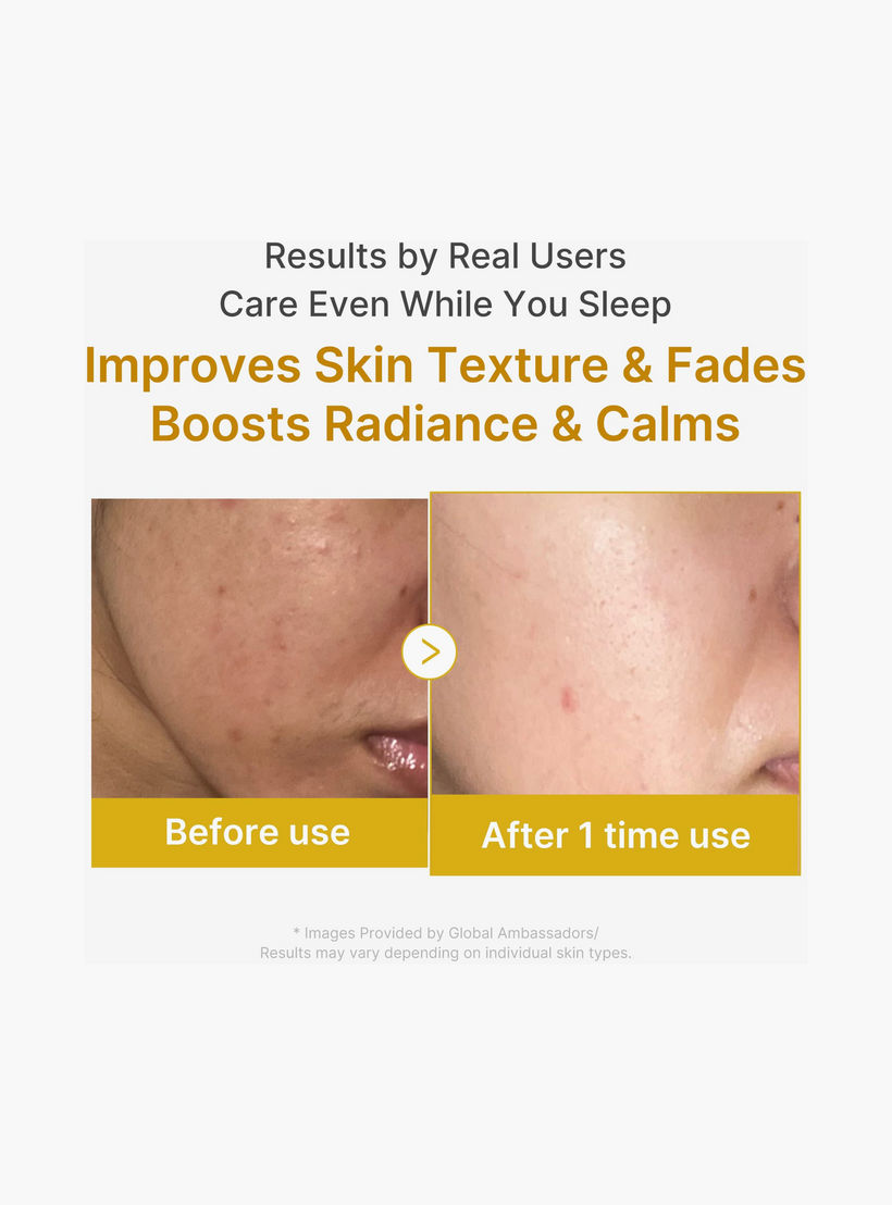 قناع ميديكوب الليلي بالكركم وحمض الكوجيك 75 مل-beautyandpersonalcare-skin-masks-sleepingmask-image-4