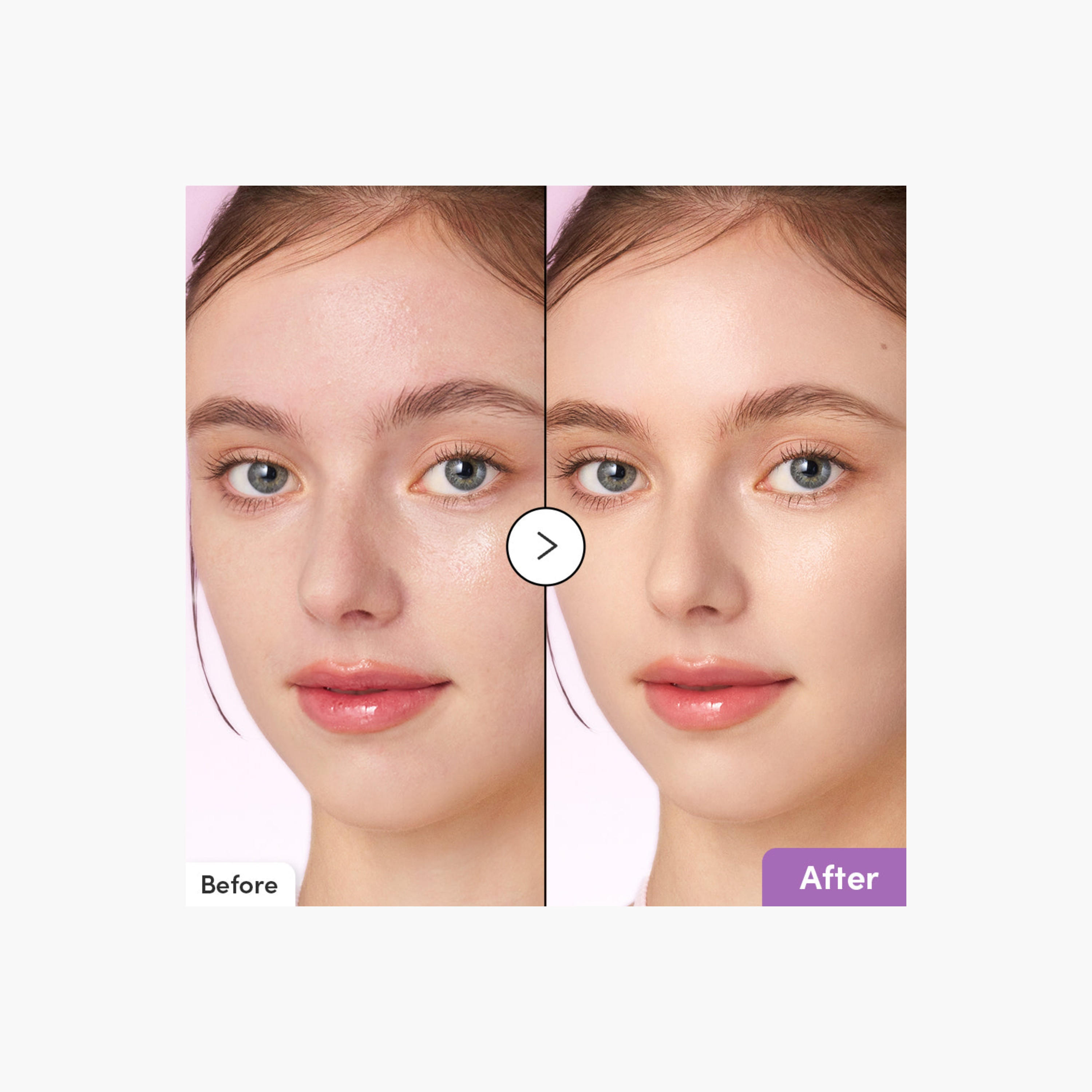 EQQUALBERRY Purple PDRN Pore Minimising Serum-beautyandpersonalcare-kbeauty-skin-suncare-bodysunscreen-image-2