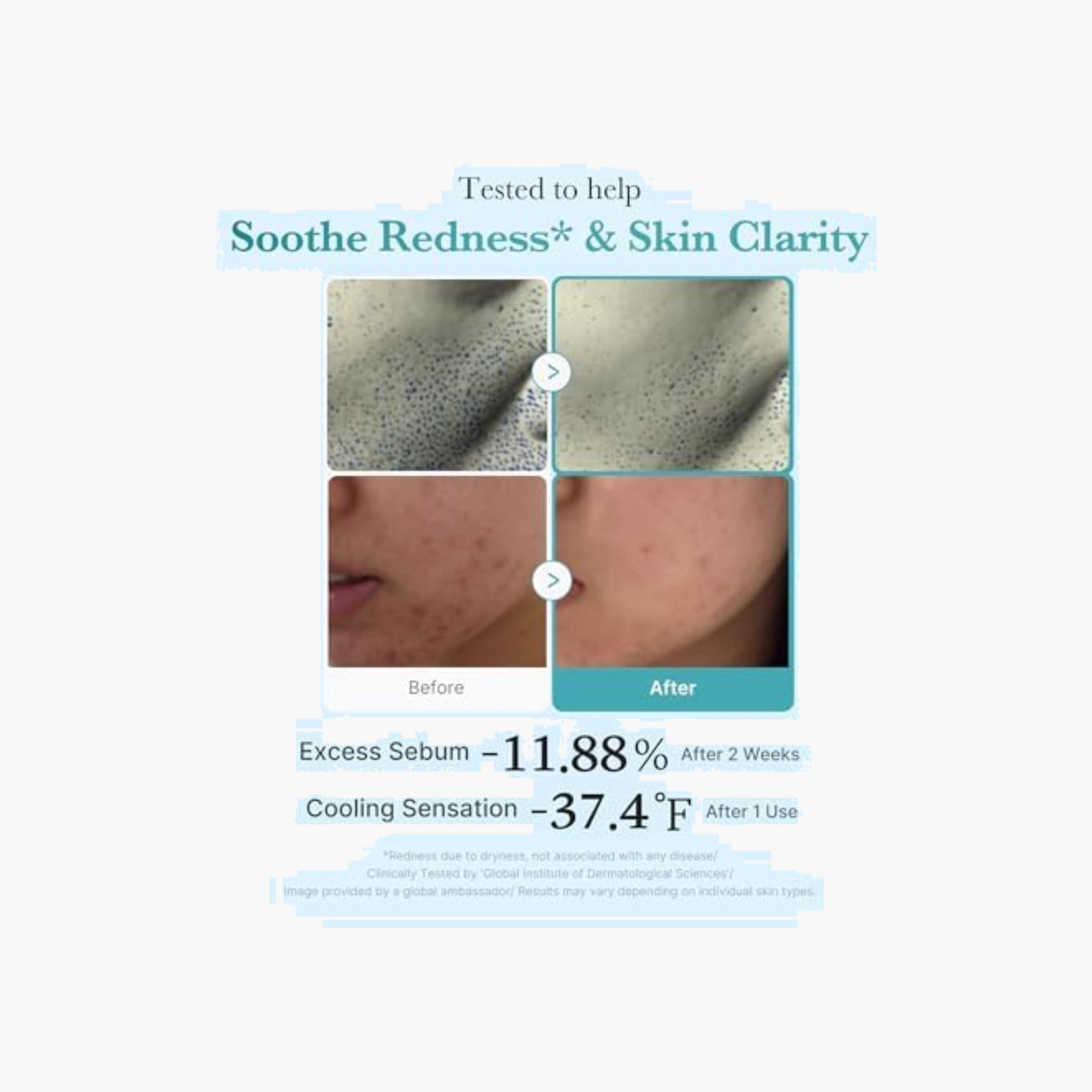 MEDICUBE Azelaic Niacinamide Clear Facial Toner-beautyandpersonalcare-skin-cleansers-tonerandmists-image-6