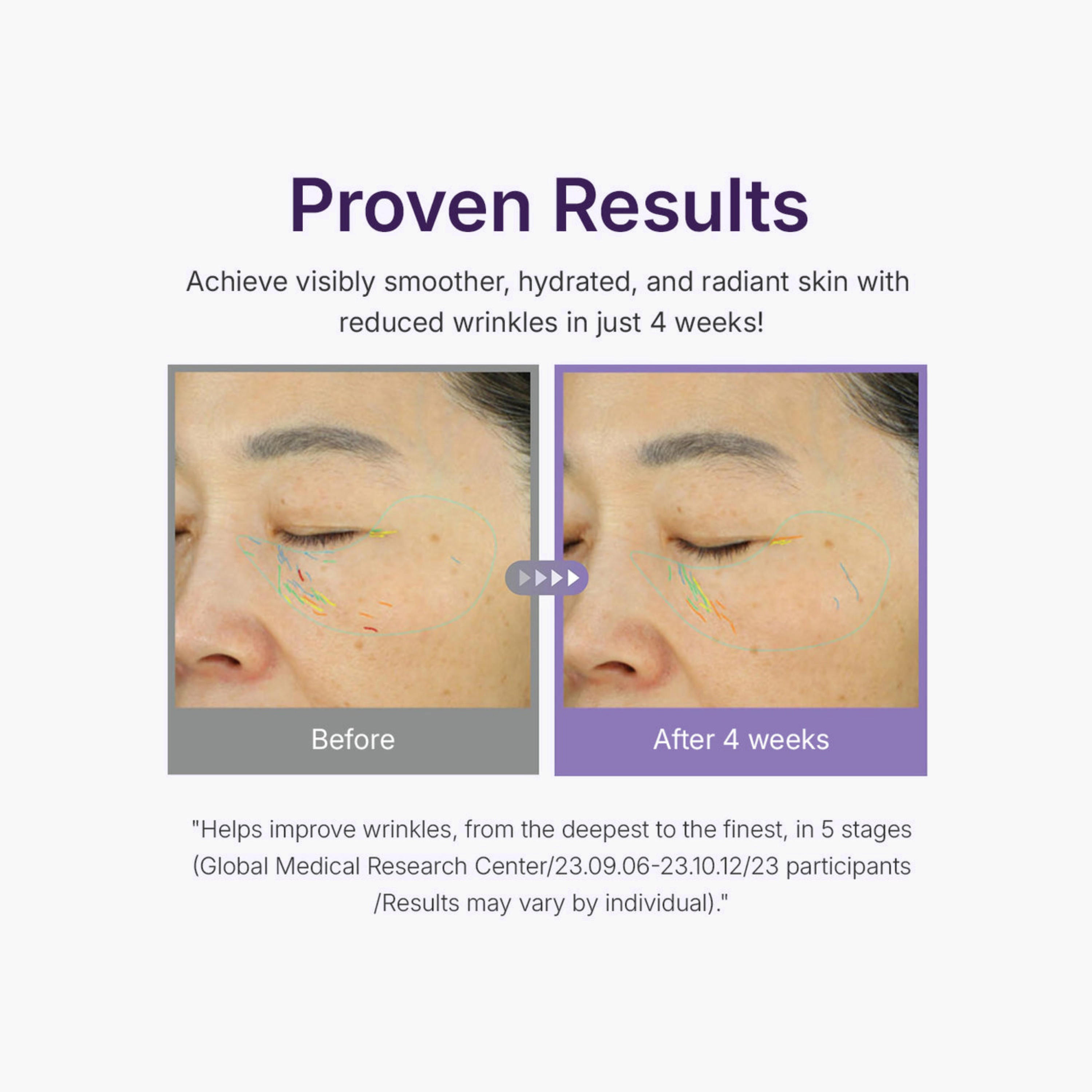 Centellian24 Active Firming Lifting Serum 50ml-beautyandpersonalcare-skin-treatmentsandserums-image-2