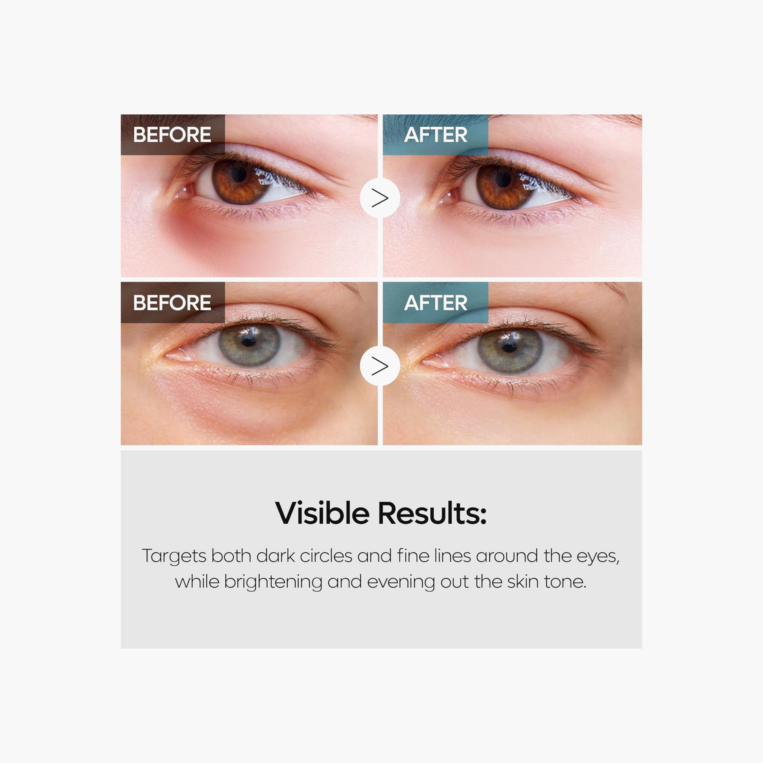كريم العين مزدوج المفعول من دكتور ميلاكسين ريتينال 40 غرام-beautyandpersonalcare-kbeauty-skin-eyecare-image-5