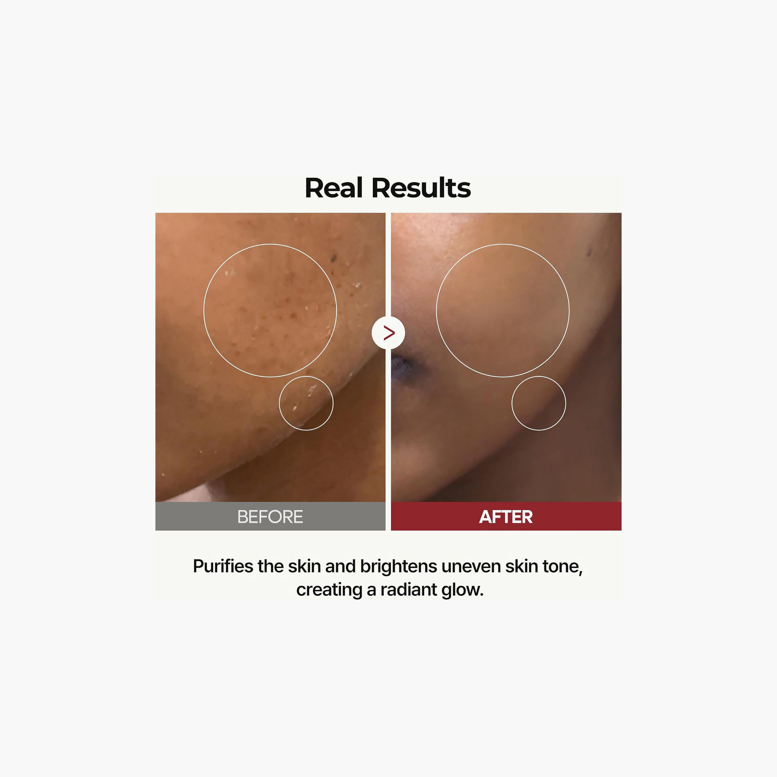 Dr.Melaxin Peel Shot Glow White Rice Toner 200Ml-beautyandpersonalcare-skin-cleansers-tonerandmists-image-3