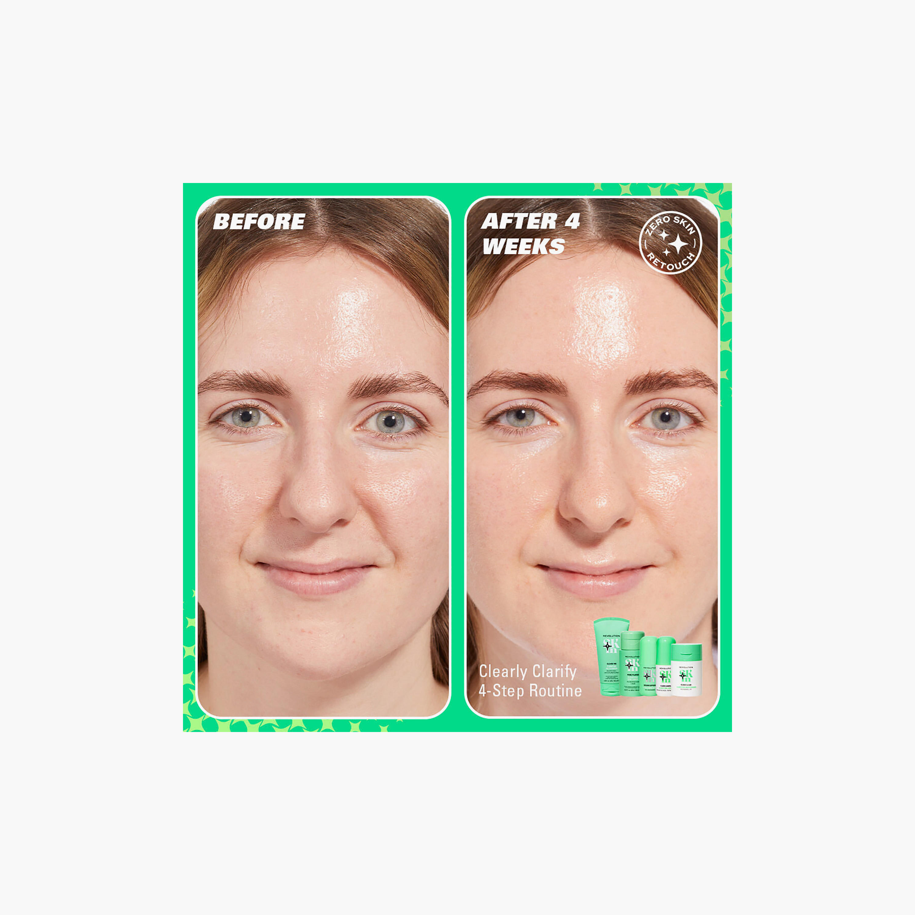 Revolution Skin Clearly Me Clarifying Gel Cleanser 150Ml-beautyandpersonalcare-kbeauty-skin-cleansers-facewash-image-2