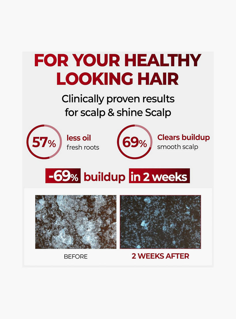 شامبو كوندال الطبيعي بالمسك الأبيض والكافيين 500 مل-beautyandpersonalcare-hair-haircare-shampoos-image-3
