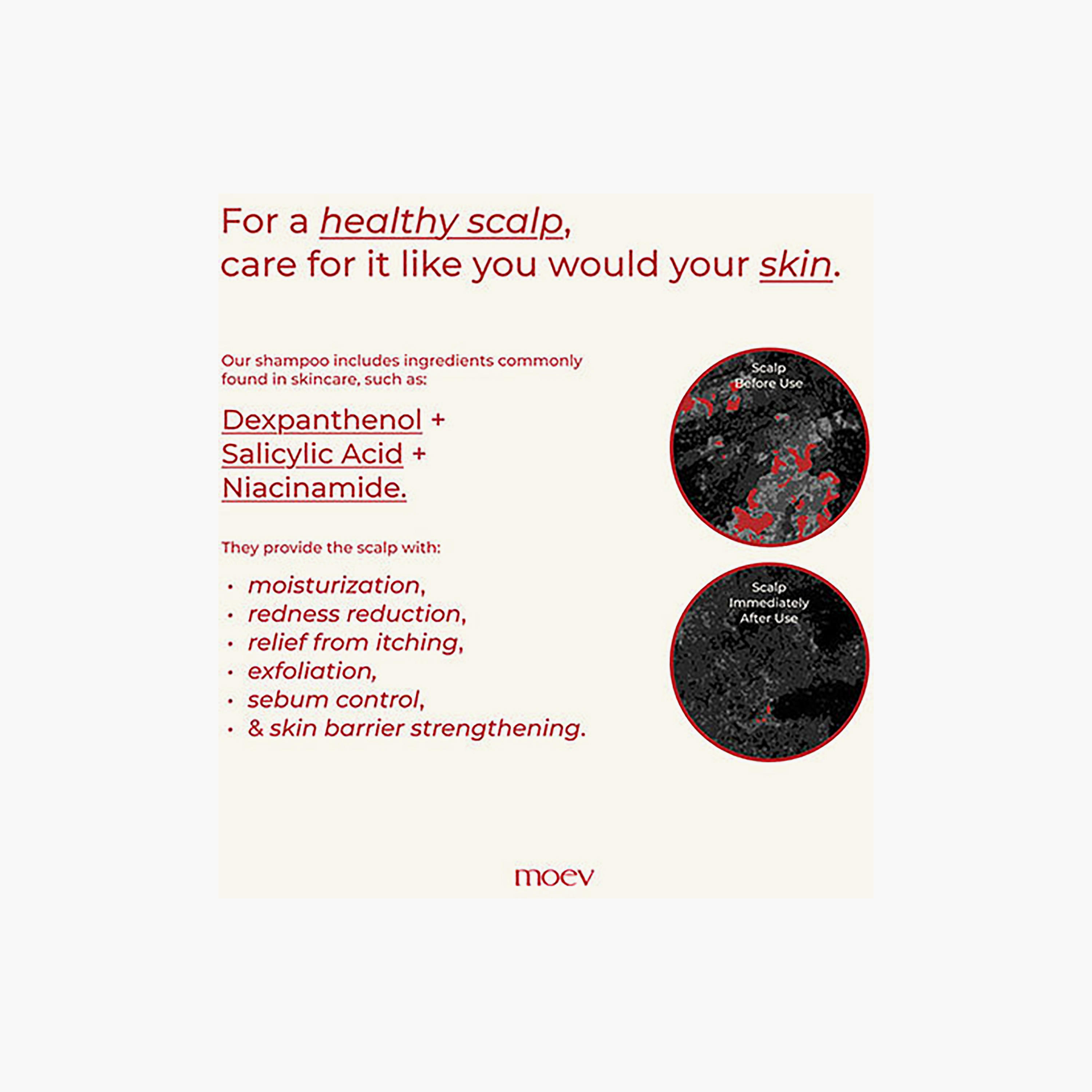 شامبو مويف أنوركاتين™ 300 مل-beautyandpersonalcare-hair-haircare-shampoos-image-7