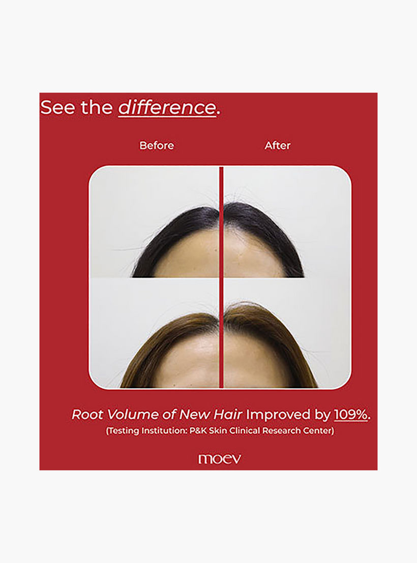 شامبو مويف أنوركاتين™ 300 مل-beautyandpersonalcare-hair-haircare-shampoos-image-8