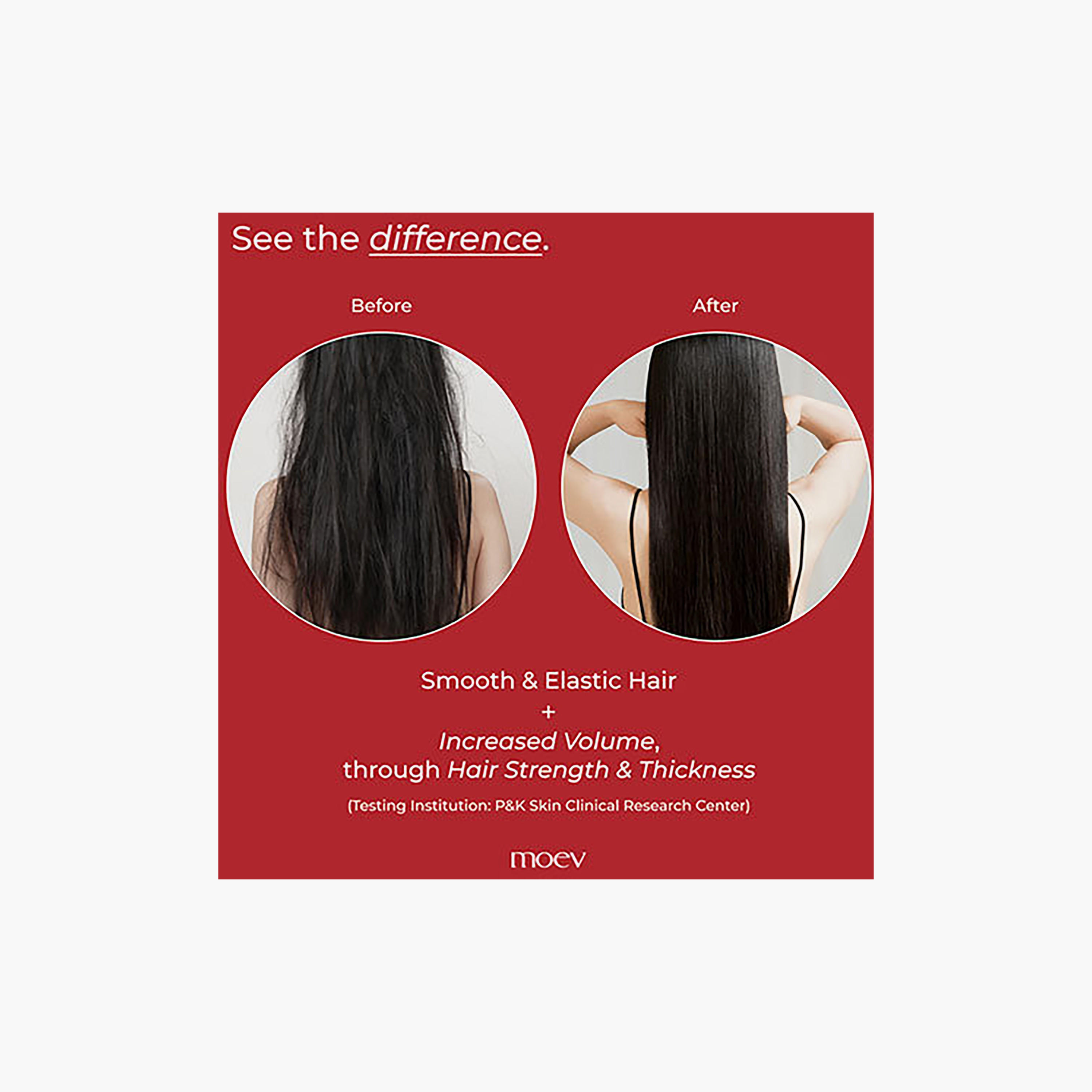 شامبو مويف أنوركاتين™ 300 مل-beautyandpersonalcare-hair-haircare-shampoos-image-9